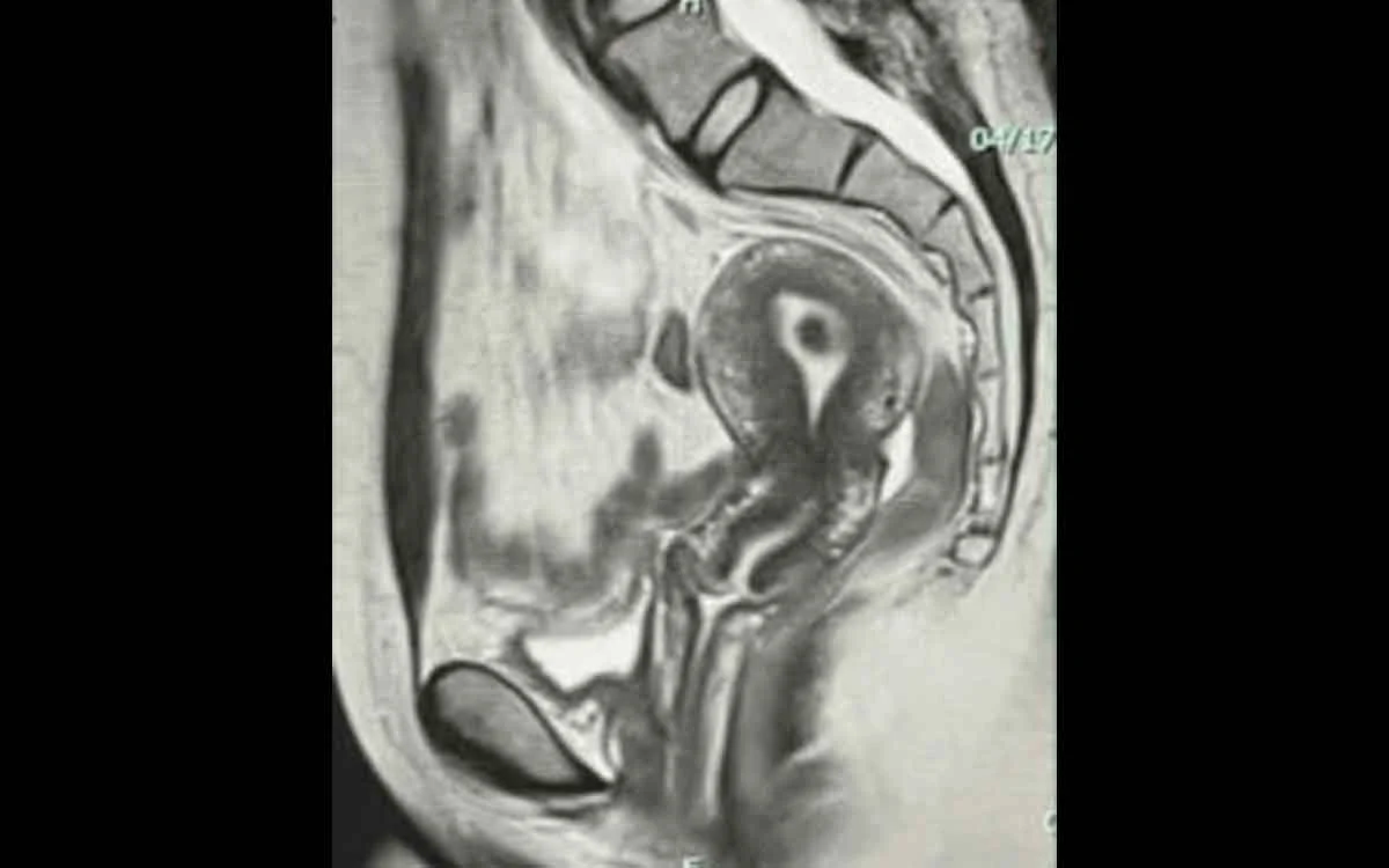 The Women’s Imaging Center